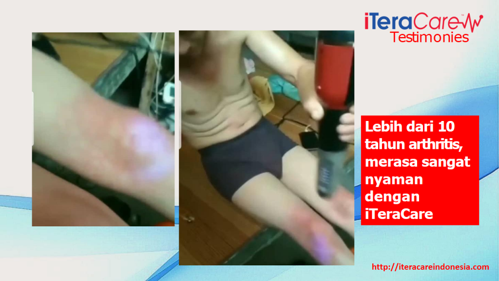 Testimoni - Arthritis