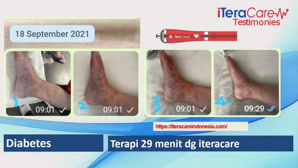 Testimoni - Diabetes