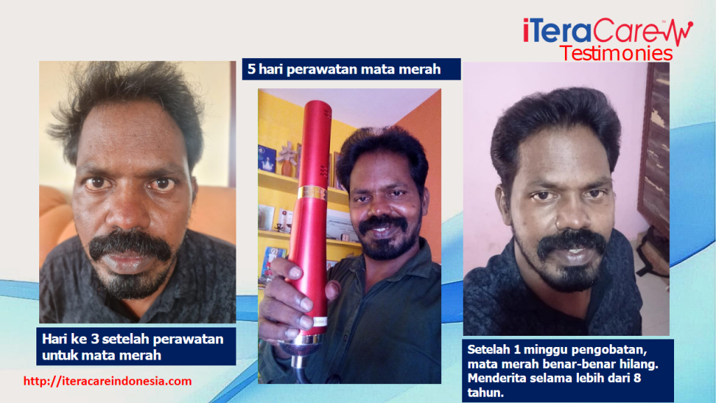 Testimoni - Eyes Red