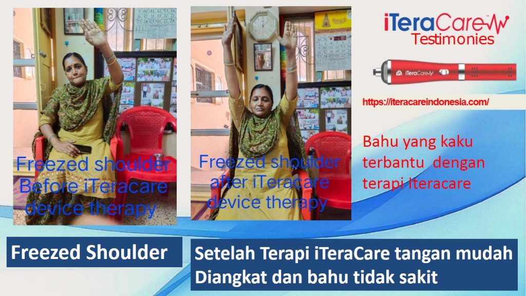Testimoni - Frozen Shoulder