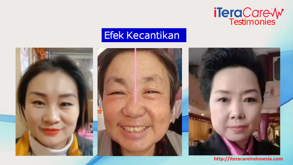 Testimoni - Wajah Flek