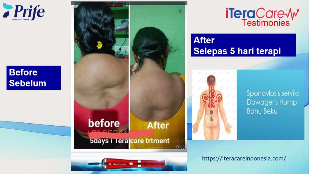 Testimoni - bengkak Tengkuk